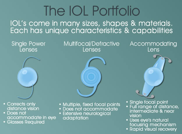 Toric IOL Lens For Cataract Surgery